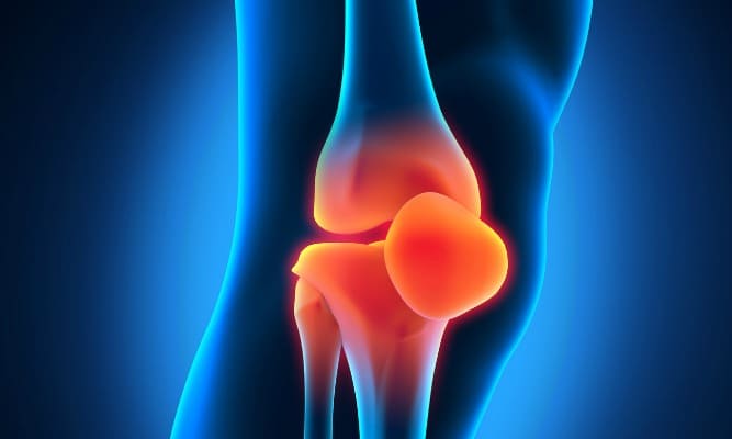 Prothèse totale de genou